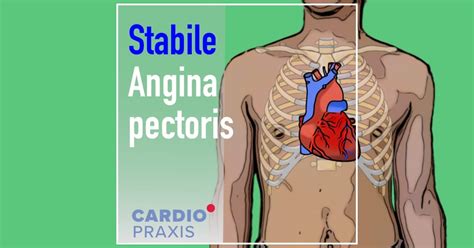 angina pectoris anfall